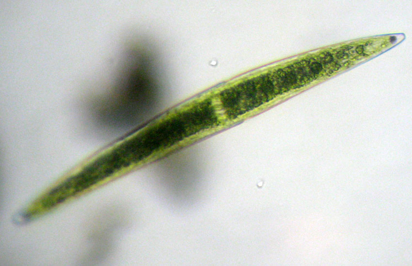 Presunzione: Closterium venus?
